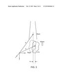 SYSTEM AND METHOD FOR PATIENT-SPECIFIC MOTION MANAGEMENT diagram and image