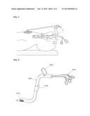 CURVED MANUAL SURGICAL EQUIPMENT diagram and image