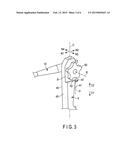 INSERTION DEVICE diagram and image