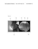 RADIOSCOPY SYSTEM diagram and image