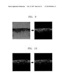 METHOD OF PROCESSING OPTICAL COHERENCE TOMOGRAPHIC IMAGE AND APPARATUS FOR     PERFORMING THE METHOD diagram and image