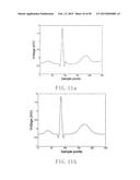 ELECTROCARDIOGRAPHY SIGNAL EXTRACTION METHOD diagram and image