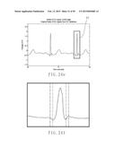 ELECTROCARDIOGRAPHY SIGNAL EXTRACTION METHOD diagram and image