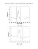 ELECTROCARDIOGRAPHY SIGNAL EXTRACTION METHOD diagram and image