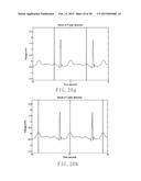 ELECTROCARDIOGRAPHY SIGNAL EXTRACTION METHOD diagram and image