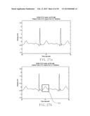 ELECTROCARDIOGRAPHY SIGNAL EXTRACTION METHOD diagram and image