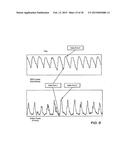 Monitoring System for Identifying an End-Exhalation Carbon Dioxide Value     of Enhanced Clinical Utility diagram and image