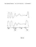 Monitoring System for Identifying an End-Exhalation Carbon Dioxide Value     of Enhanced Clinical Utility diagram and image