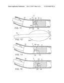 DEVICE FOR TREATING CHRONIC TOTAL OCCLUSION diagram and image