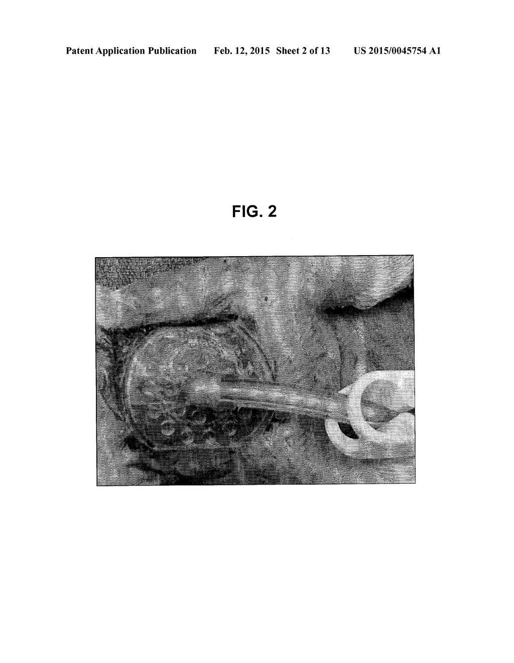 ACTIVATION OF BONE AND CARTILAGE FORMATION - diagram, schematic, and image 03