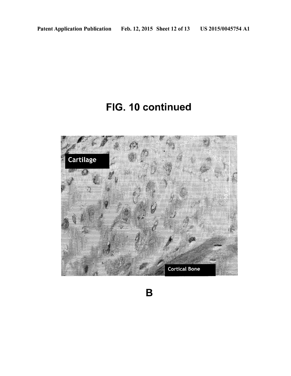 ACTIVATION OF BONE AND CARTILAGE FORMATION - diagram, schematic, and image 13