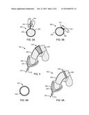 FLUID CAPTURING DEVICE AND METHODS diagram and image