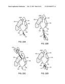 FLUID CAPTURING DEVICE AND METHODS diagram and image