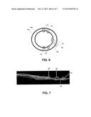 MICROELECTRODE-EQUIPPED SUBDURAL THERAPEUTIC AGENT DELIVERY STRIP diagram and image