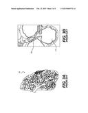 DEVICES AND METHODS FOR TREATING A LUNG diagram and image