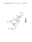 DEVICES AND METHODS FOR TREATING A LUNG diagram and image