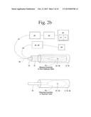 System for treating gastric reflux by tightening a lower esophageal     sphincter diagram and image