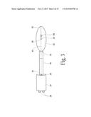 System for treating gastric reflux by tightening a lower esophageal     sphincter diagram and image