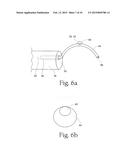 System for treating gastric reflux by tightening a lower esophageal     sphincter diagram and image