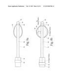 System for treating gastric reflux by tightening a lower esophageal     sphincter diagram and image