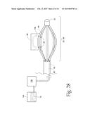 System for treating gastric reflux by tightening a lower esophageal     sphincter diagram and image