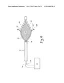 SPHINCTER TREATMENT APPARATUS diagram and image