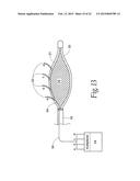 SPHINCTER TREATMENT APPARATUS diagram and image