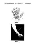 ORTHOPEDIC FASTENER DEVICE diagram and image