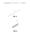 ORTHOPEDIC FASTENER DEVICE diagram and image