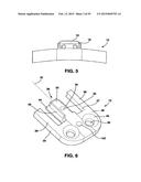 Static Compression Device diagram and image