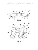 Static Compression Device diagram and image