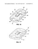 Static Compression Device diagram and image