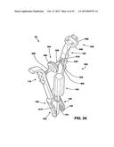 Static Compression Device diagram and image