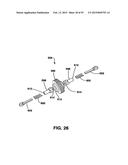 Static Compression Device diagram and image