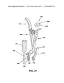 Static Compression Device diagram and image