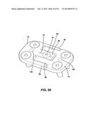 Static Compression Device diagram and image