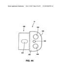 Static Compression Device diagram and image