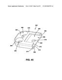 Static Compression Device diagram and image