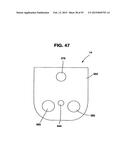 Static Compression Device diagram and image