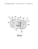 Static Compression Device diagram and image