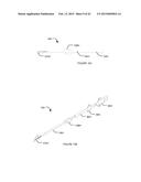 TRANSVASCULAR NERVE STIMULATION APPARATUS AND METHODS diagram and image