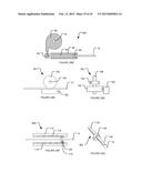 TRANSVASCULAR NERVE STIMULATION APPARATUS AND METHODS diagram and image