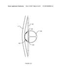 TRANSVASCULAR NERVE STIMULATION APPARATUS AND METHODS diagram and image