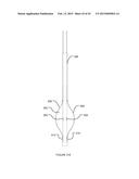 TRANSVASCULAR NERVE STIMULATION APPARATUS AND METHODS diagram and image