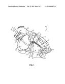 DELIVERY CATHETER INCLUDING SIDE PORT AND ELECTRODES diagram and image