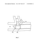 DELIVERY CATHETER INCLUDING SIDE PORT AND ELECTRODES diagram and image