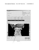 ROBOTIC SYSTEM AND METHOD FOR SPINAL AND OTHER SURGERIES diagram and image