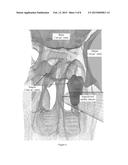 ROBOTIC SYSTEM AND METHOD FOR SPINAL AND OTHER SURGERIES diagram and image