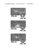 ENDOSCOPIC SURGICAL BLADE AND METHOD OF USE THEREOF diagram and image