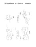ORTHOPEDIC DUAL POCKET COMPRESSION PLATE AND METHOD OF SURGERY diagram and image